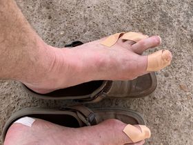 War torn feet